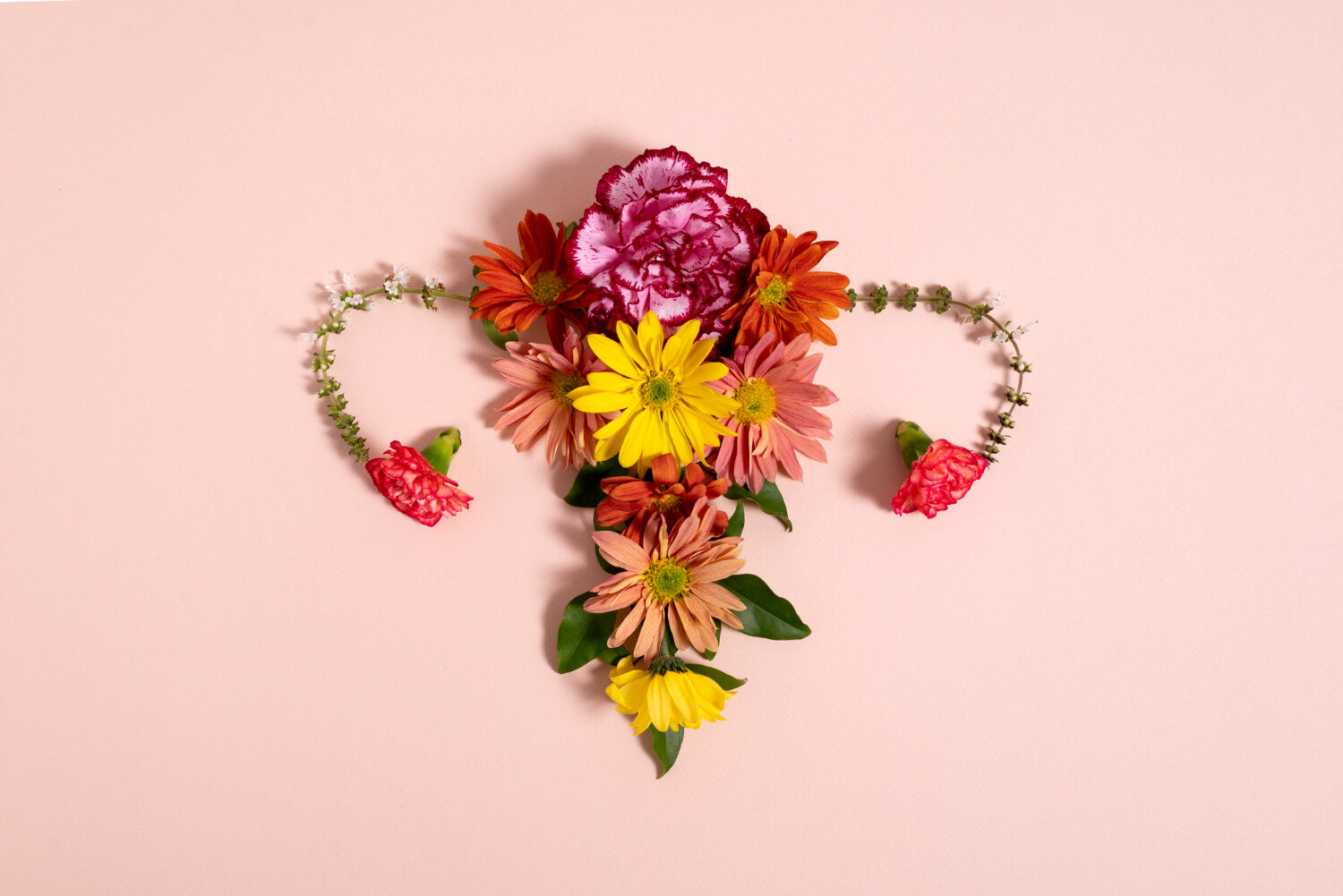 Endometriosis