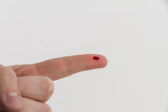 How to Reduce Blood Inflammation Naturally: Diet & Habits That Work
